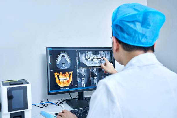 Best Emergency Dental Extractions in Santee, SC
