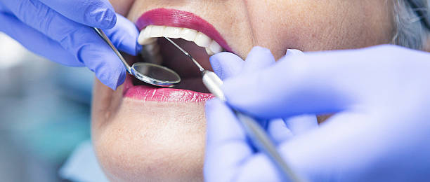 Best Broken or Cracked Tooth Emergency Dentist in Santee, SC